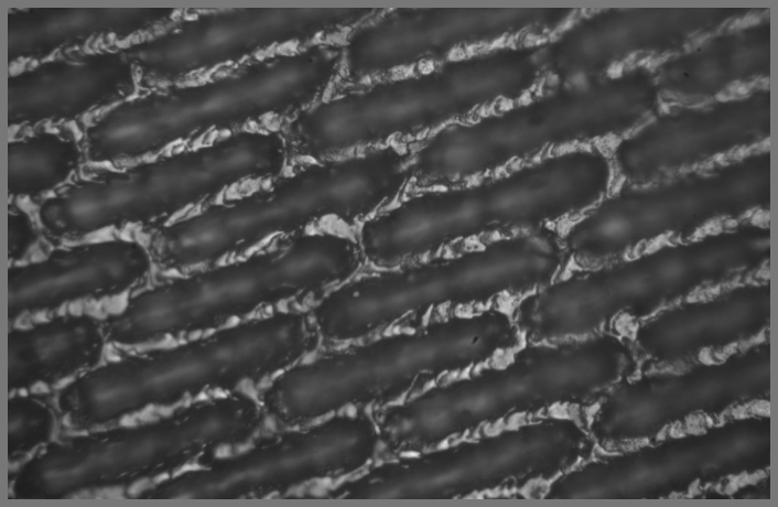 Anilox roll micrograph before cleaning
